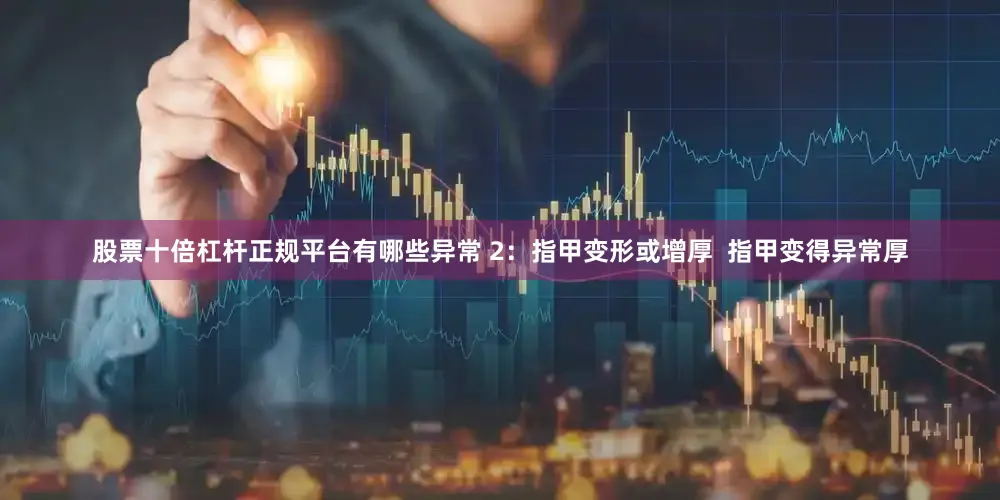 股票十倍杠杆正规平台有哪些异常 2：指甲变形或增厚  指甲变得异常厚